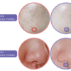 MINI PIN re:Face Skin Care set - Image 5