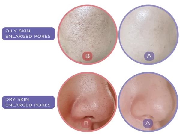 Re:Face Skin Serum Ampoules - Image 5